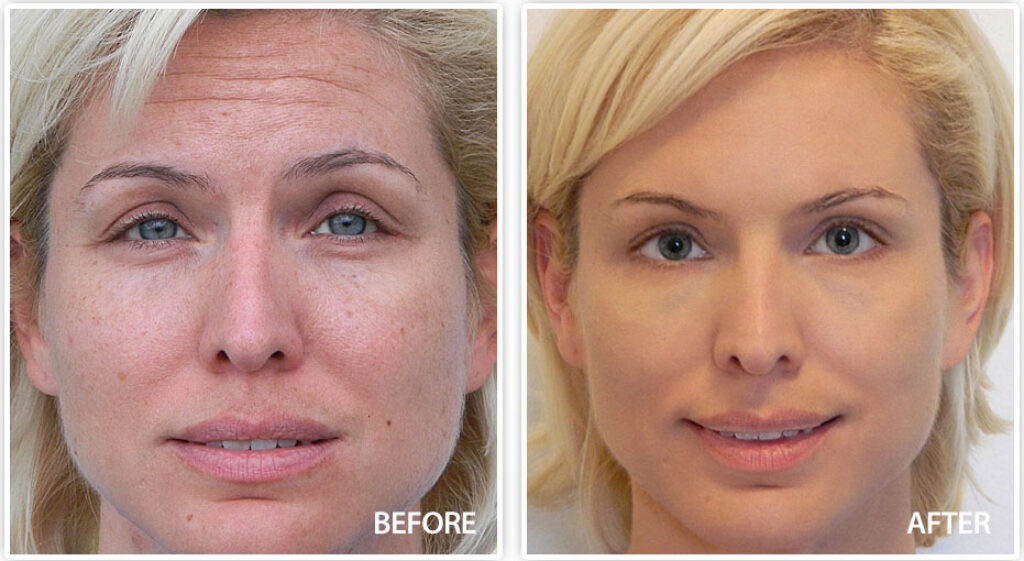 anti aging skincare for sensitive skin