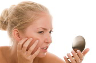 how can you get rid of acne scars naturally in 3 weeks